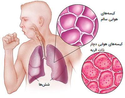 چگونه ریه‌‌ها می‌توانند سالم بمانند؟